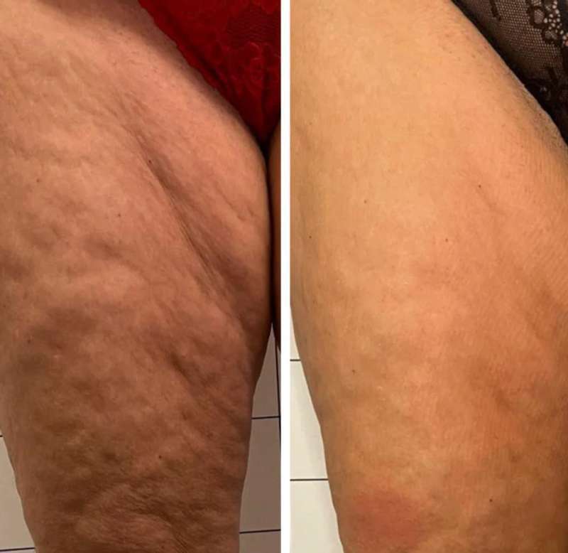 Foto de cliente